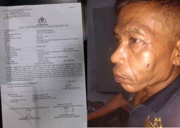 Tiga Oknum Anggota Brimob Diduga Centeng Pekerjaan Galian Optik Aniaya Anggota Ormas dan Wartawan di Tangerang