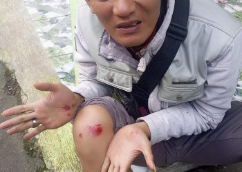 3 Wartawan di Kroyok Oknum Komite Sekolah di Bogor Barat, Korban Buat LP ke Polsek Cigudeg