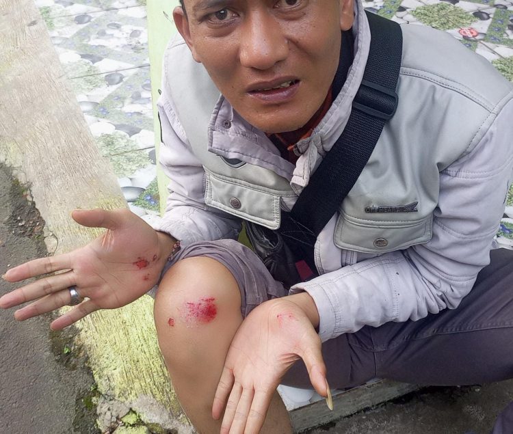 3 Wartawan di Kroyok Oknum Komite Sekolah di Bogor Barat, Korban Buat LP ke Polsek Cigudeg