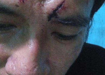 Penganiayaan Disertai Dugaan Pemerasan di Kampung Pabangbon Berakhir di Polisi, Diduga Kades Terlibat