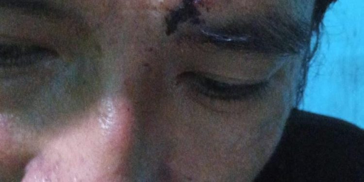 Penganiayaan Disertai Dugaan Pemerasan di Kampung Pabangbon Berakhir di Polisi, Diduga Kades Terlibat