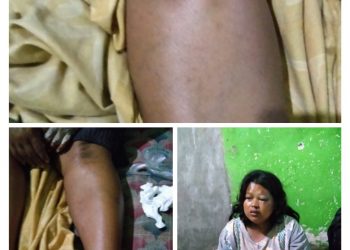 Di Duga Pengendara Mobil AVANZA Sopir Grab Tabrak 1 Pengndara Motor Menjadi korban, Di Jalan Raya Ciapus