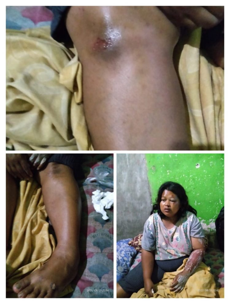 Di Duga Pengendara Mobil AVANZA Sopir Grab Tabrak 1 Pengndara Motor Menjadi korban, Di Jalan Raya Ciapus