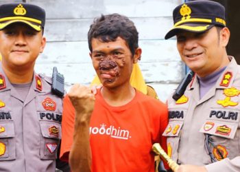 Peduli Warga, Kapolres Bengkalis Bantu Penderita Penyakit Kanker Kulit Berobat ke Rumah Sakit