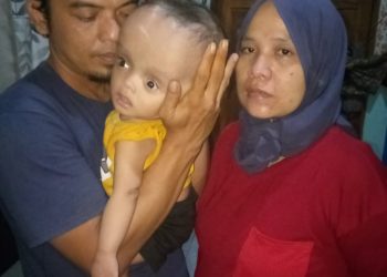 GWI Harapkan Bupati Tangerang  Perduli Pada Bayi Penderita Hydrocephalus