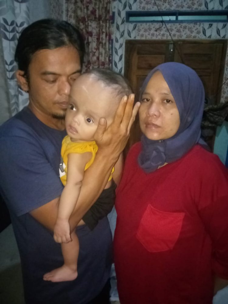GWI Harapkan Bupati Tangerang  Perduli Pada Bayi Penderita Hydrocephalus
